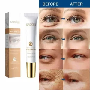 Instant Eye Cream For Anti Aging Dark Circles Bags Puffiness Great Under Eye Skin Face Tightening Eye Lift Treatment Care - Image 6