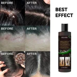 100ml Eelhoe Shampoo Anti-Itching Shampoos Anti-Dandruff Anti-Itching Shampoo Anti-Shedding Refreshing Shampoo Profissional - Image 6