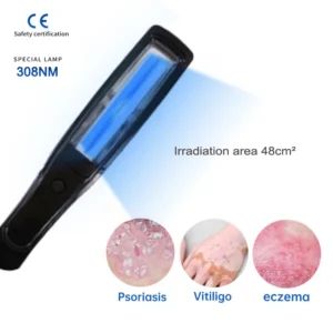Uvb Lamp Vitiligo Physical Therapy Equipment Narrowband Light Lamp Medical Light Source UV 311nm Therapy For Psoriasis Eczema - Image 5