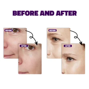 30ML Bakuchiol Serum With Retinol Skin Moisturizing & Firming Smooth Fine Lines Essence for Wrinkles Anti-aging Serum for Women - Image 4