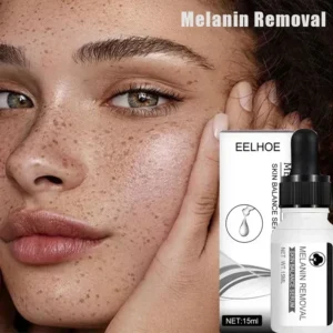 Dark Spots Remover Serum Powerful Removal Black Dot Melasma Chloasma Niacinamide Whitening Moisture Freckle Face Skin Care - Image 2