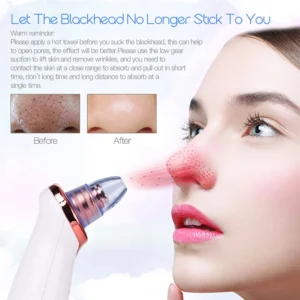 Blackhead Remover Diamond Dermabrasion Nose Vacuum Pore Cleanser Acne Pimple Suction Extractor USB Rechargeable Skin Care Tool - Image 5