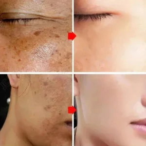 Dark Spot Correcting Face Serum Anua 10% Niacinamide+ 4% Tranexamic Acid Whitening Moisturizing Brighten Glow Korean Skin Care - Image 2