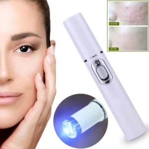 Laser therapy Keloid scar Laser Therapy Leg Repair Pen Reduce Legs Imcomfortable Improving Blood Circulation Varicose Veins Pen - Image 3