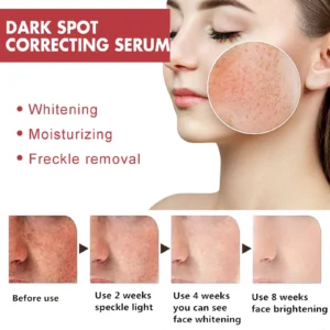 Dark Spot Correcting Face Serum Anua 10% Niacinamide+ 4% Tranexamic Acid Whitening Moisturizing Brighten Glow Korean Skin Care - Image 4