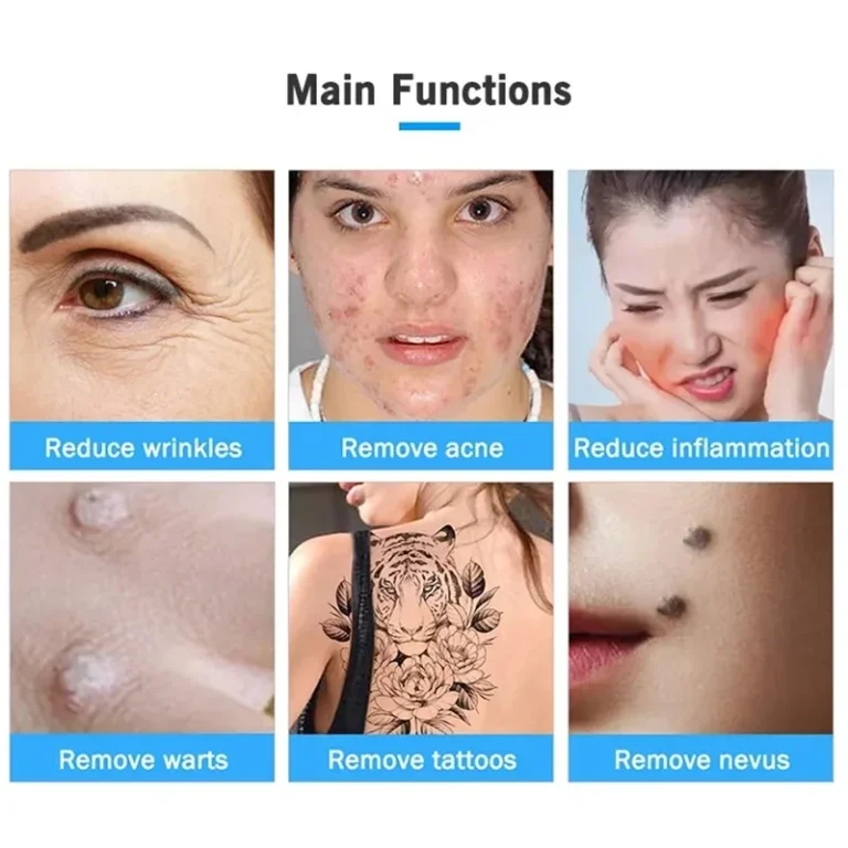 NEW Professional 2 in 1 Ozone Plasma Pen Mole Removal Pen Sterilize Acen Skin Spot Remover Face Lifting Skin Eyelid Lift - Image 6