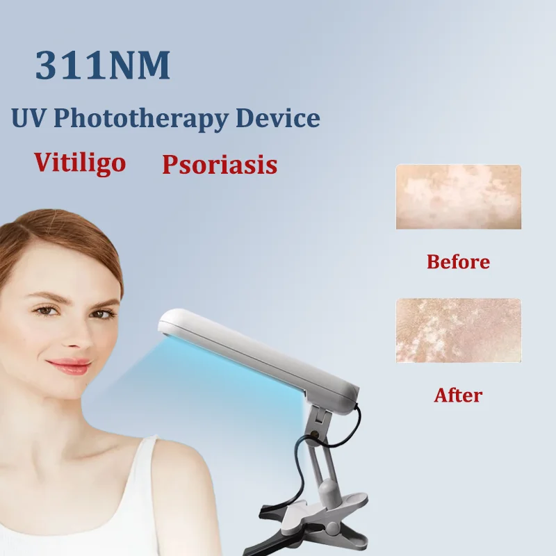 UVB Phototherapy Narrow 311nm uv phototherapy lamp uvb light therapy psoriasis for Vitiligo - Image 2