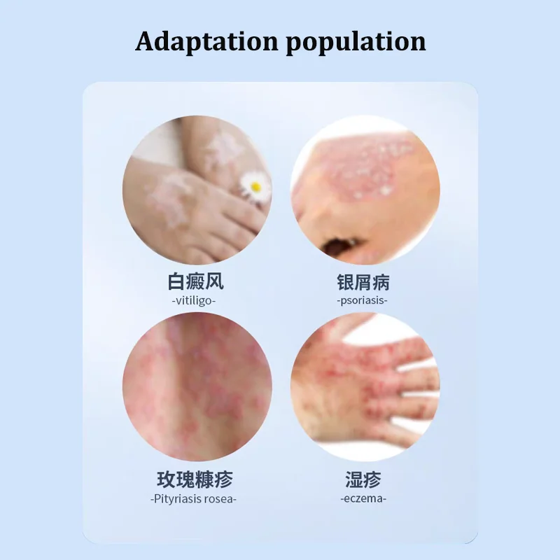 UVB Phototherapy Narrow 311nm uv phototherapy lamp uvb light therapy psoriasis for Vitiligo - Image 6