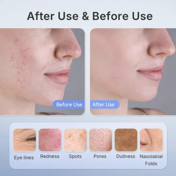 Hello Face 510K Wireless Near-Infrared and Red Light Therapy Facial Mask For Powerful Anti-ageing Professional Ultra-light Mask - Image 5