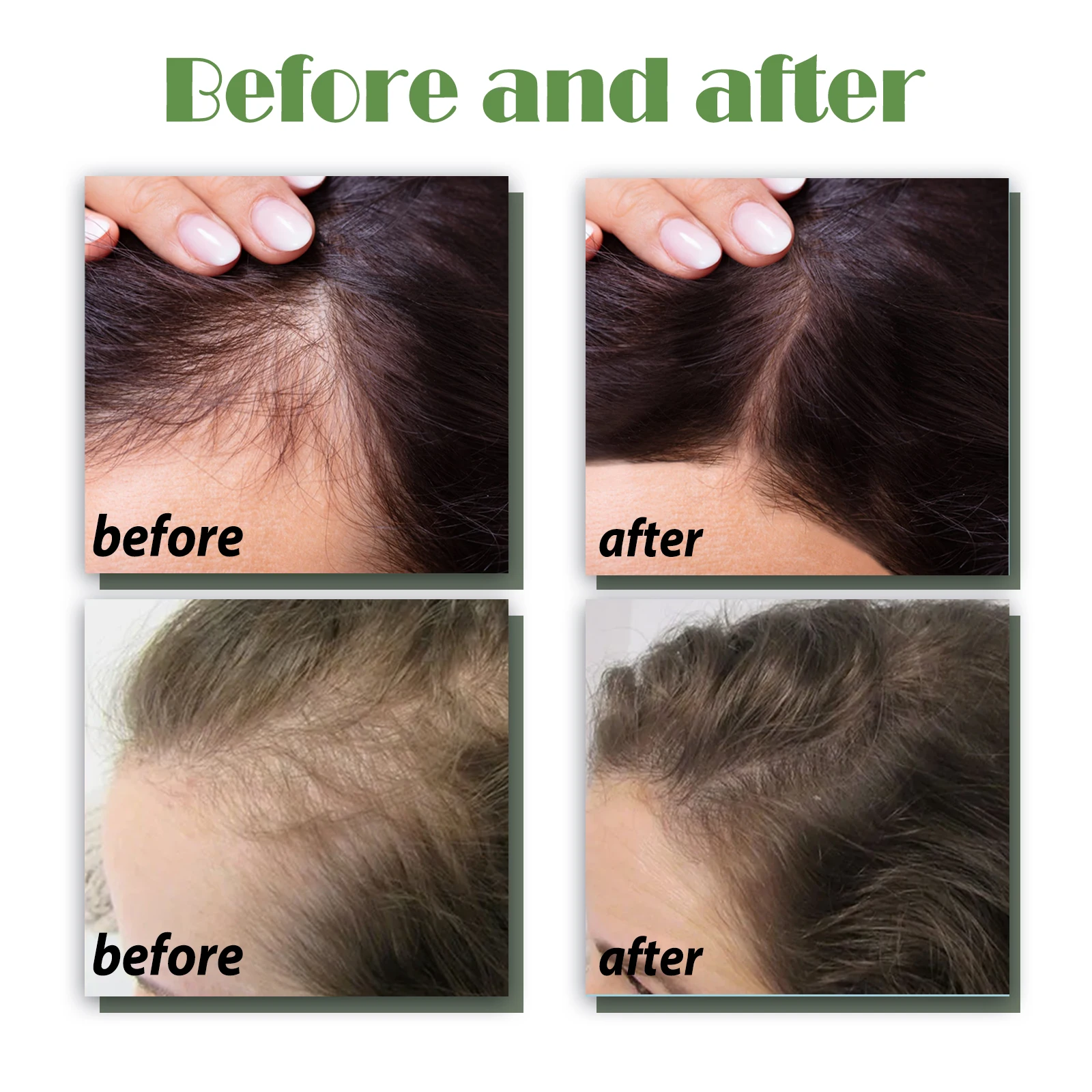 120ml Hair Growth Support Spray with Herbal Extracts Nourishing Scalp Tonic for Thinning Hair Root Strengthening Shine Enhancer - Image 4