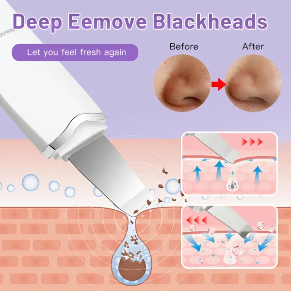 Electric Ultrasonic Skin Scrubber Vibration Face Spatula Peeling Blackhead Remover Facial Lifting Cleansing Ultrasonic Skin Care - Image 4