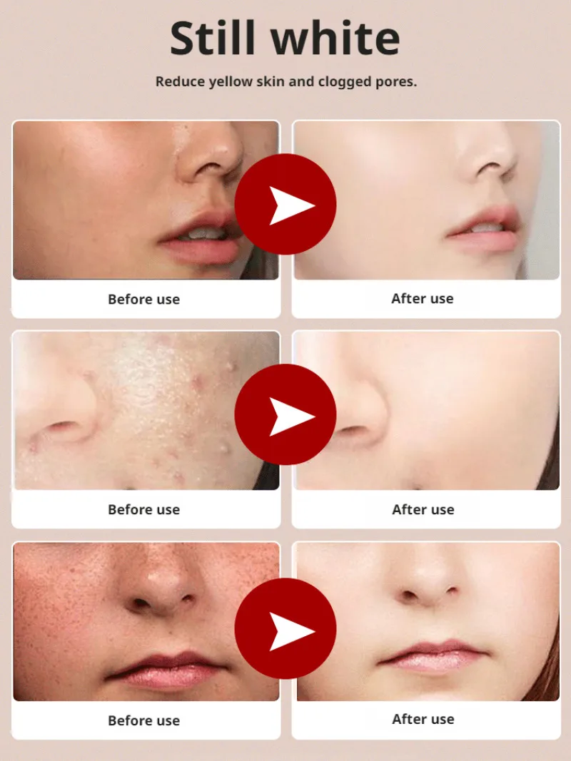 Niacinamide Whitening Facial Cleanser Shrink Pores Deep Cleaning Brightening Cleanser Oil Control Hydrating Face Wash Cleanser - Image 3