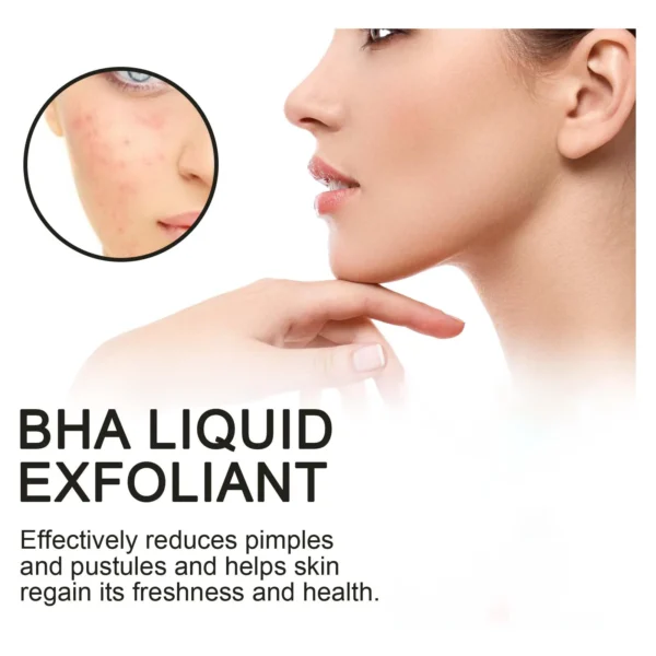2% BHA Liquid Salicylic Acid Exfoliant Reduces Pimples Dark Spot Corrector Pore Minimizing Smoothing Hydrating Facial Essence - Image 2