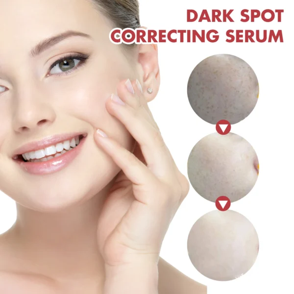 Niacinamide Tranexamic Dark Correcting Essence For Post-Acne Marks Acne Hyperpigmentation And Even Skin Tone Facial CorrectSerum - Image 3
