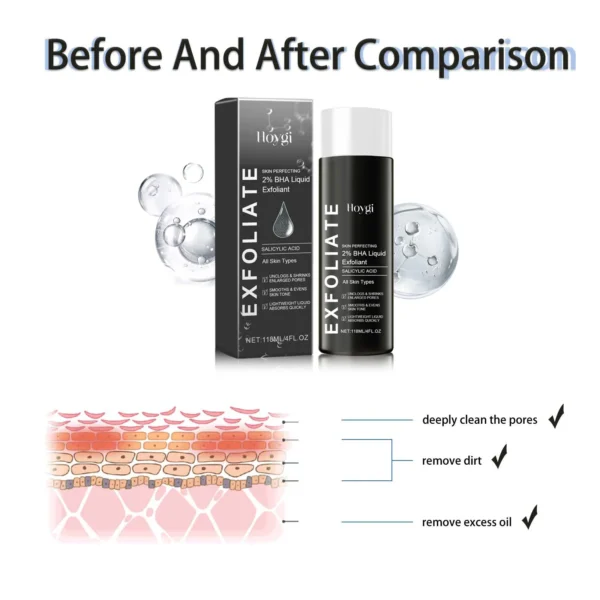 2% BHA Liquid Salicylic Acid Exfoliant Reduces Pimples Dark Spot Corrector Pore Minimizing Smoothing Hydrating Facial Essence - Image 5