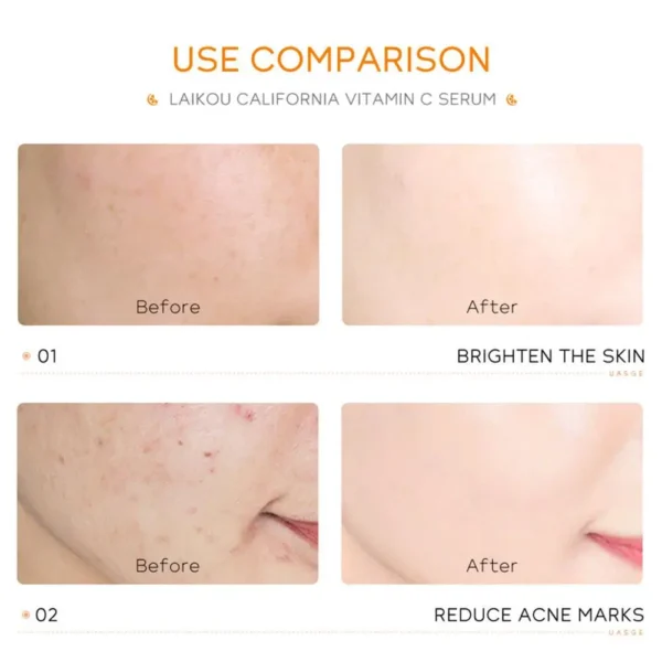 New Vitamin C Serum Hyaluronic Acid For Face Collagen Glowing Serum Lifting Firming Fade Fine Lines Anti-aging Essence Skin Care - Image 3