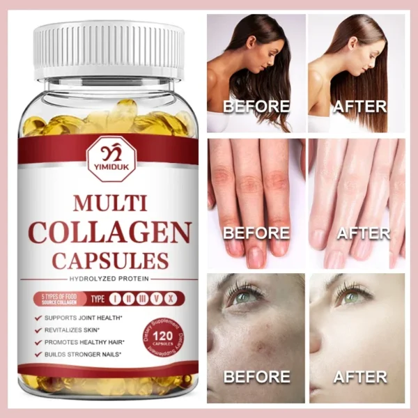 Multi-Collagen Capsules -Type I II III V X - Anti-Aging Healthy Joints Hair Skin Bones Nails Hydrolyzed Collagen Peptides Unisex - Image 3