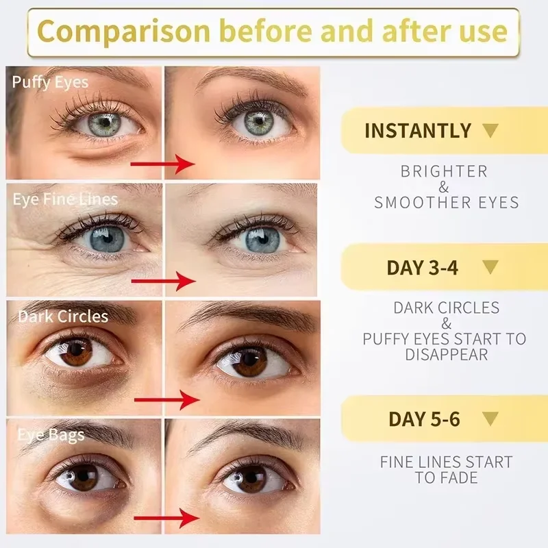 Instant Eye Bag Removal Cream Retinol Anti-Wrinkle Firming Skin Fade Fine Lines Anti Dark Circle Puffiness Brighten Eye skinCare - Image 3
