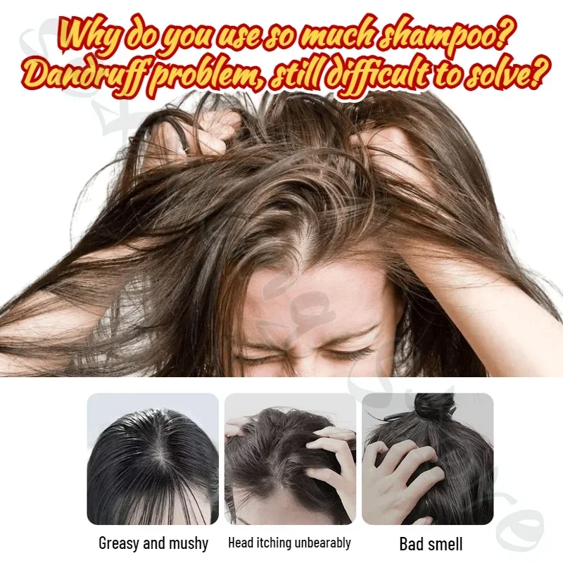 Selenium Sulfide Antipruritic Shampoo Refreshing Oil Control Deep Cleansing to Remove Hair Follicles from Scalp Pimples 200ml - Image 4