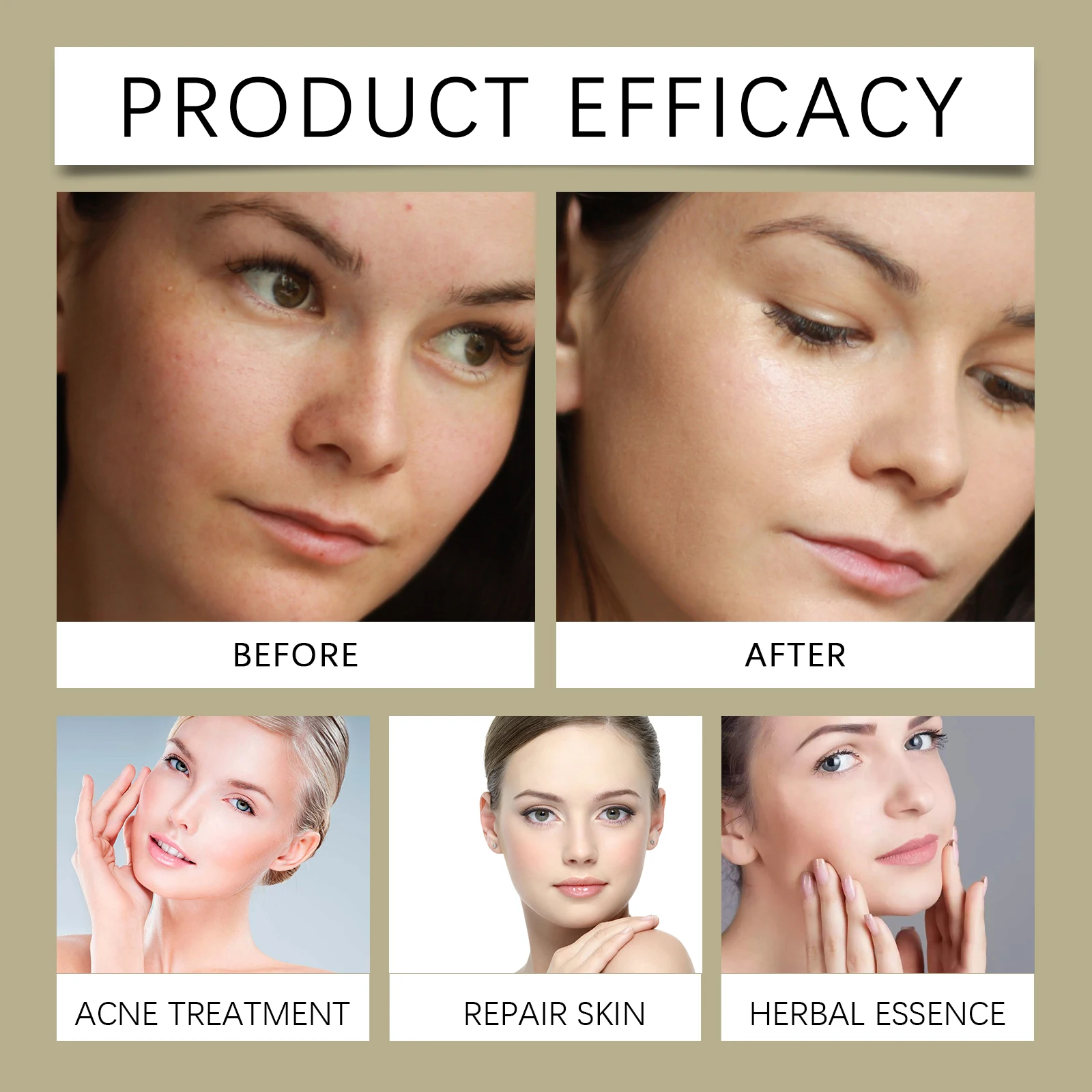 Glycolic Acid 7% Moisturizing Toner Remove Acne Improve Skin Condition Replenish Water Moisturize Skin Tender Skin&Toner Essence - Image 2