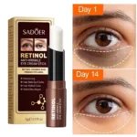 Retinol Eye Cream Remove Dark Circles Eye Bags Puffiness Reduces Wrinkle Eye Serum Stick Dark Circles Removal Man Woman Eye Care