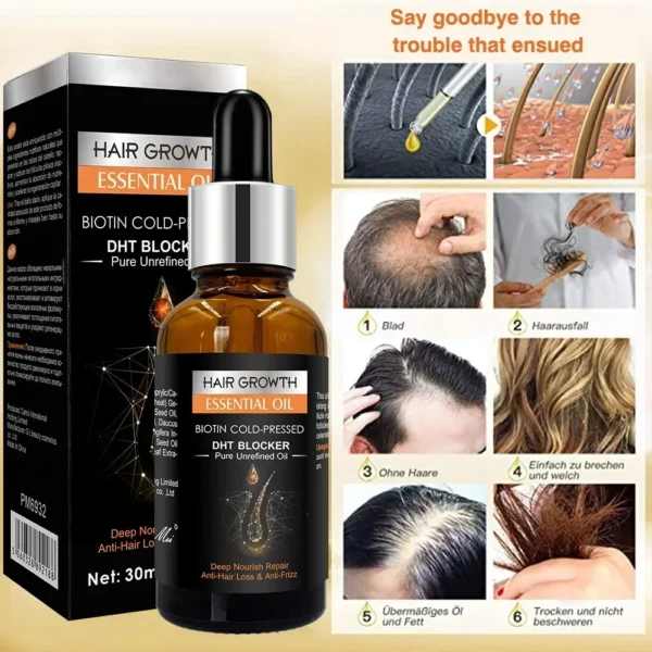 High Repurchase,Hair Growth Oil,Biotin DHT Blocker,Anti-Loss Shampoo,Boost Regrowth,Increase Production of Shampoo,hair Growth - Image 3