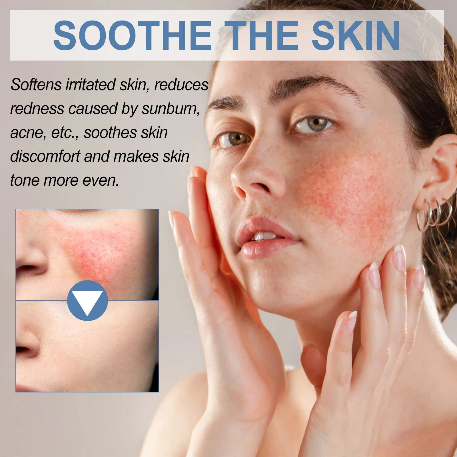 7X Facial Redness Soothing Serum Instant Rosacea Red Blood Vein Treatment Improve Sensitive Skin Barrier Repair Korean Cosmetics - Image 4