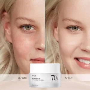 70% Intense Calming Cream with Ceramide Whitening Cream Moisturizing Facial Cream 50ml Korean Skin care Product