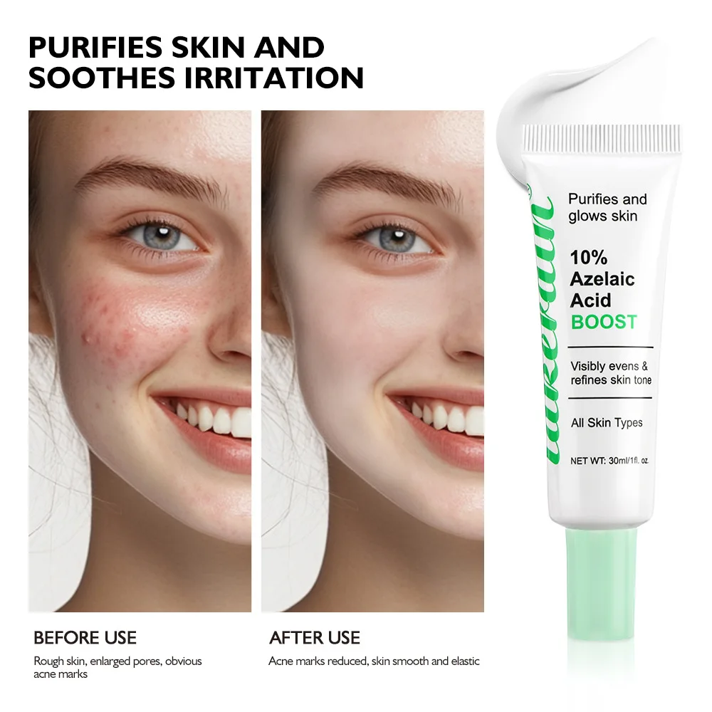 Lakerain Azelaic Acid 10% Serum Lotion Clear Acne Remove Blackheads & Acne Help Moisturize Nourish Facial Cream Essence - Image 4