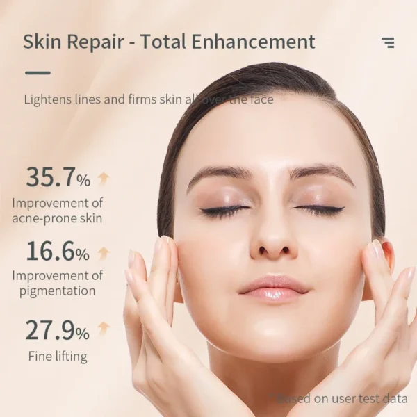 Blue Light Plasma Facial Pen 5 Levels Acne Scar Removal Skin Tightening Pore Minimizer Ozone Therapy Tool - Image 3