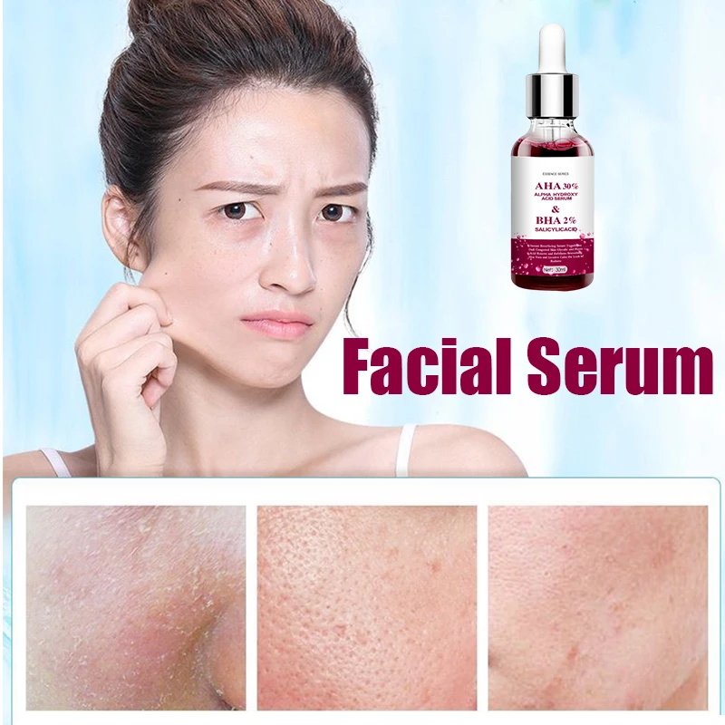 Shrink Pores Serum Salicylic Fruit Acid Face Remove Blackheads Oil Control Gel Whitening Moisturizing Smooth Skin Care - Image 3