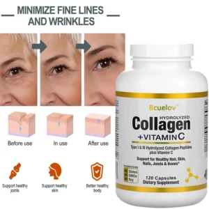 Hydrolyzed Collagen Peptides + Vitamin C, Types I & III Support Healthy Hair, Skin, Nails, Joints & Bones Boosts Immunity