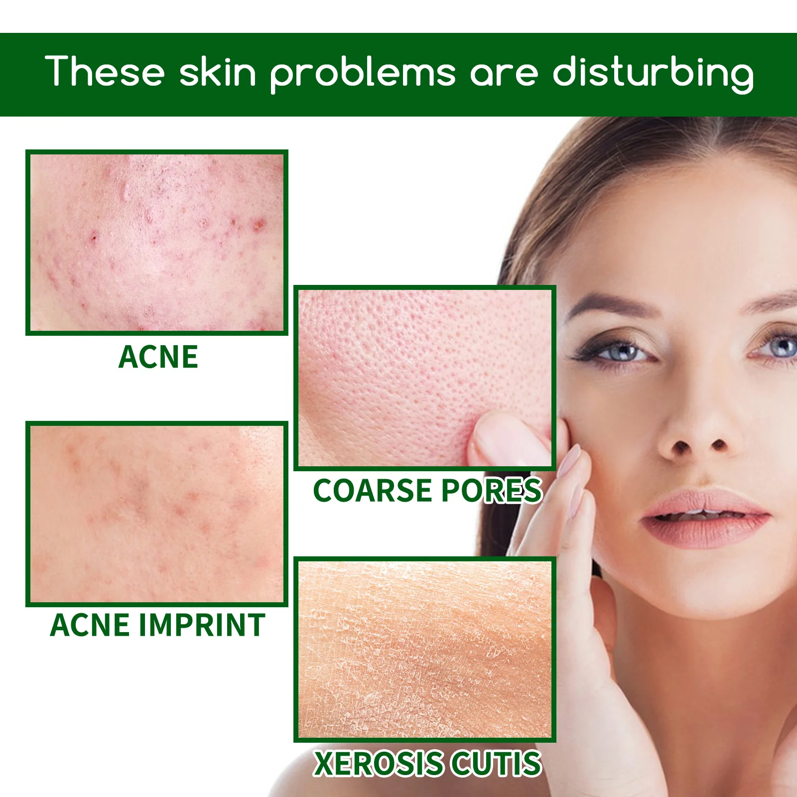 Salicylic Acid Anti Acn-e Face Serum Hydrating Fader Acne Mark Pimple Blackhead Removal Shrink Pores Oil Control Facial Essence - Image 4