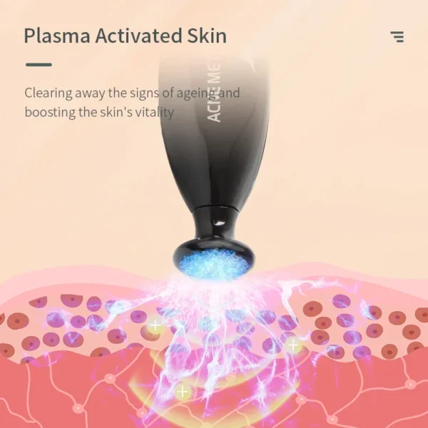 Blue Light Plasma Facial Pen 5 Levels Acne Scar Removal Skin Tightening Pore Minimizer Ozone Therapy Tool - Image 4