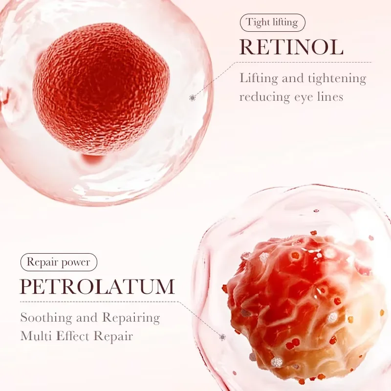 Retinol Eye Cream Remove Dark Circles Eye Bags Puffiness Reduces Wrinkle Eye Serum Stick Dark Circles Removal Man Woman Eye Care - Image 6