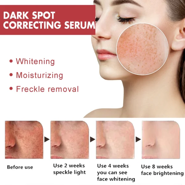 Niacinamide Tranexamic Dark Correcting Essence For Post-Acne Marks Acne Hyperpigmentation And Even Skin Tone Facial CorrectSerum - Image 4