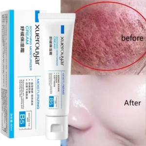 Instant Rosacea Treatment Face Cream Repair Redness Dry Sensitive Skin Improve Red Blood Cellulite Sooth Lotion Korean Cosmetics