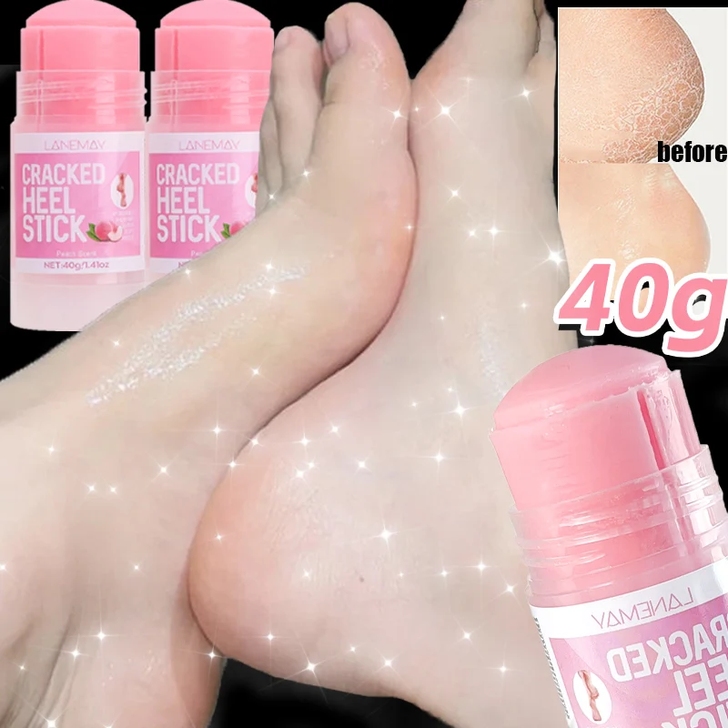 Moisturizing Feet Cream Stick Solution Repairing Softening Dry Cracked Daily Foot Care Tools Ultra-Hydrating Hand Foot Cream