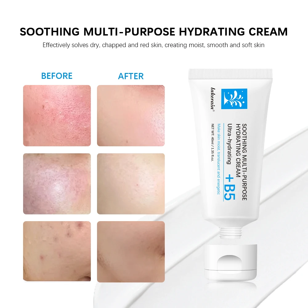 Soothing Multi-Purpose Hydrating Cream Reduces Redness Daily Helps Relieve Rough Cracked Skin Deep Skin Care - Image 2