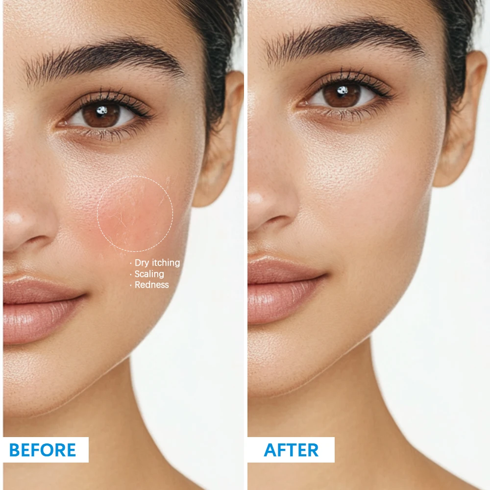 Soothing Multi-Purpose Hydrating Cream Reduces Redness Daily Helps Relieve Rough Cracked Skin Deep Skin Care - Image 3