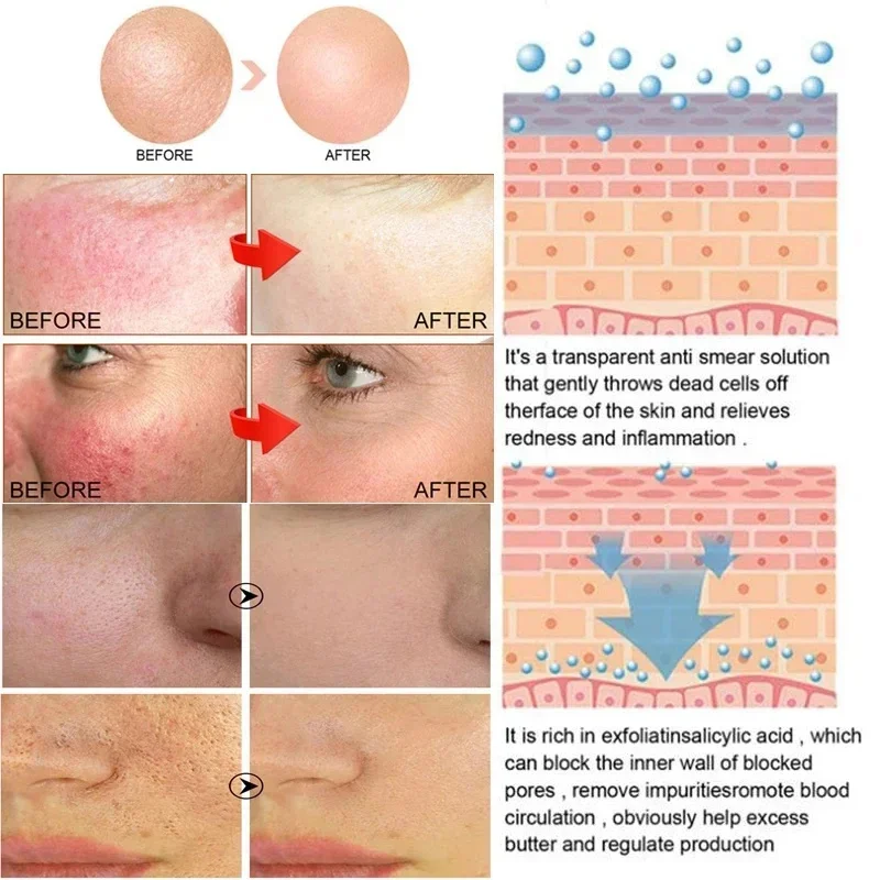 7X Facial Redness Soothing Serum Instant Rosacea Red Blood Vein Treatment Improve Sensitive Skin Barrier Repair Korean Cosmetics - Image 3