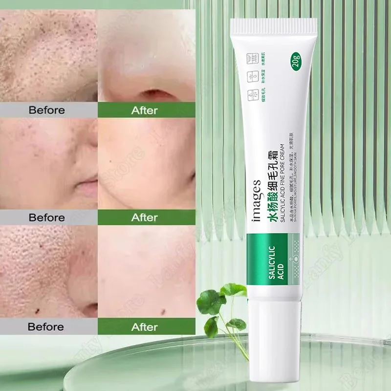 Salicylic Acid Pore Clearing Cream Shrink Pores Remove Blackheads Acne Brighten Moisturizing Smooth Skin Care Korean Products - Image 5