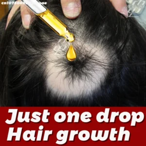 Hair Care, Hair Root Repair, Save Your Hair